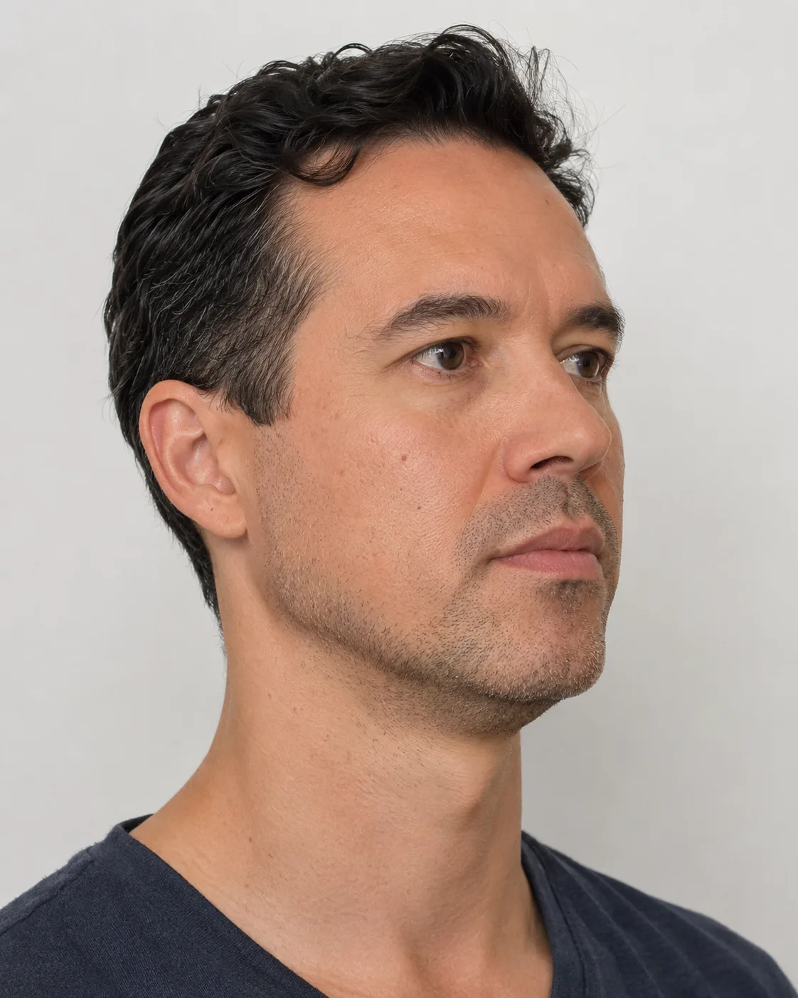 Profile portrait used to discuss suitability questions before same-day treatment discussion