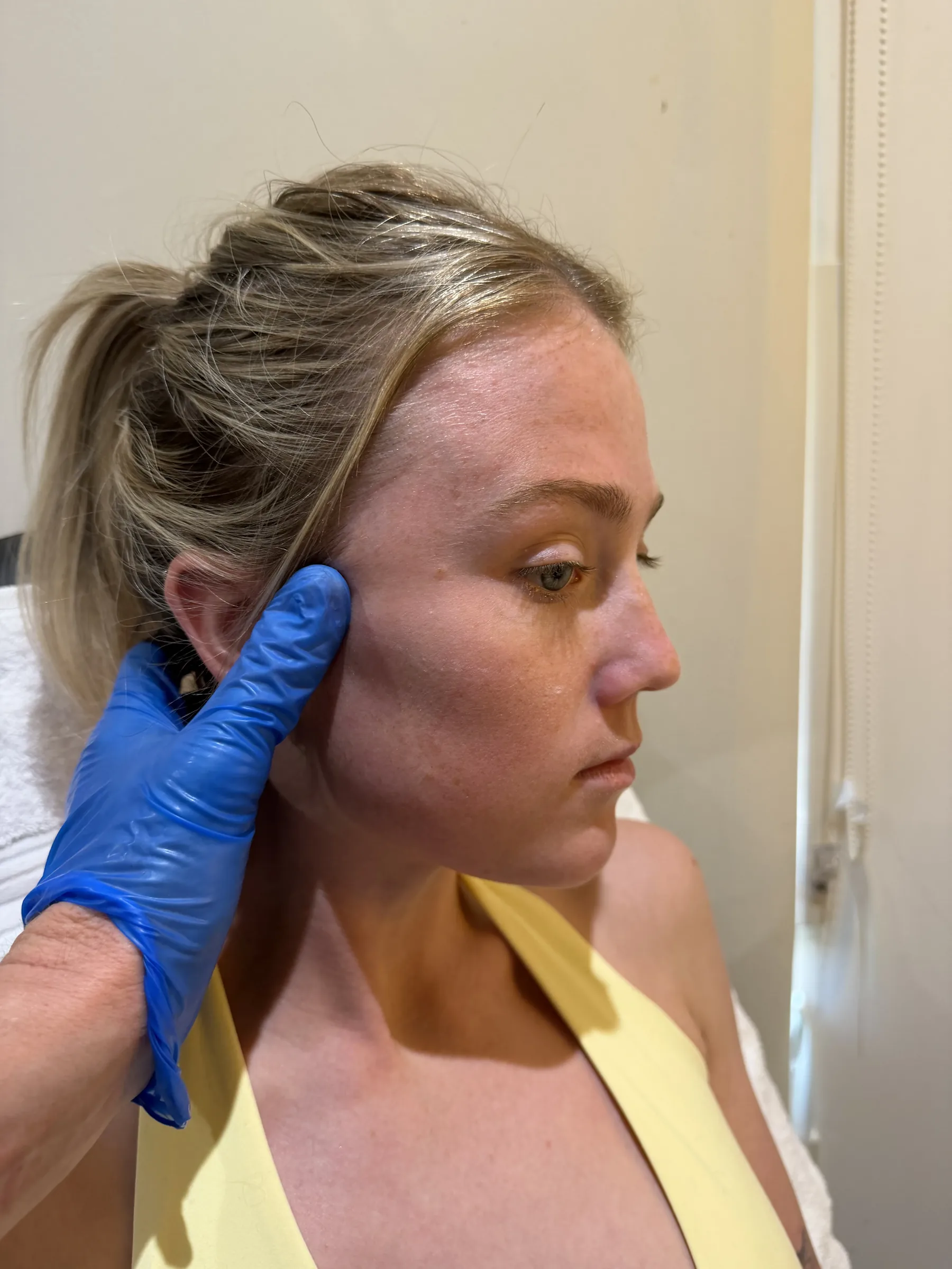 Core Aesthetics jaw muscle planning visual for Same Day Treatment And Consent
