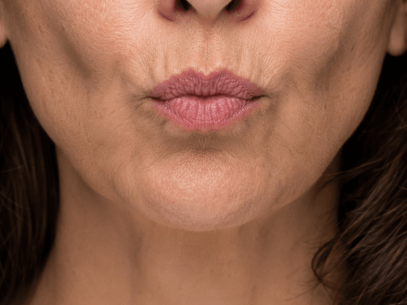 Lip border and surrounding lines shown during pursing movement