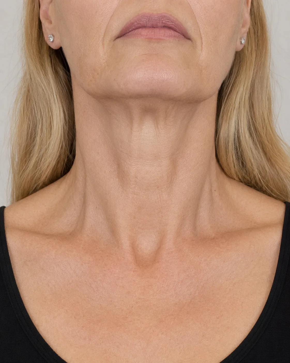 Close consultation image used to explain how sensitive facial assessment can still be handled privately and respectfully at Core Aesthetics