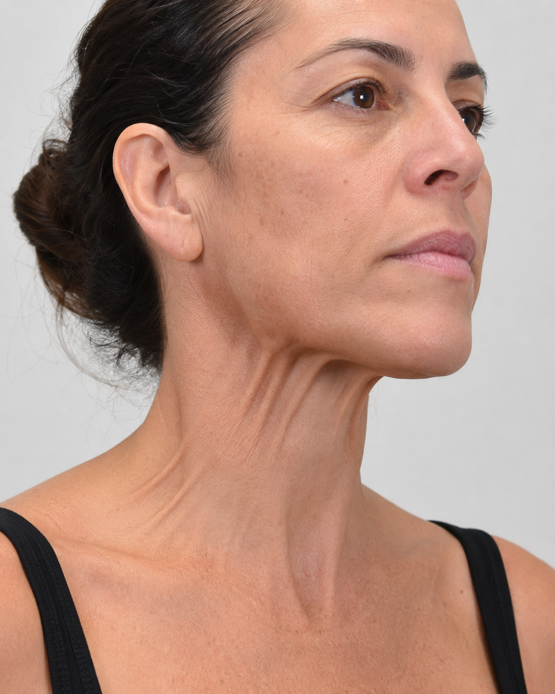 Facial ageing education and assessment context for consultation planning at Core Aesthetics in Oakleigh