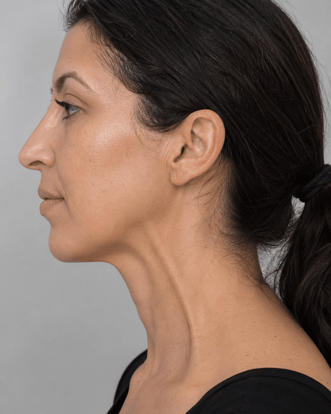 Adult profile assessment reference for consultation led planning