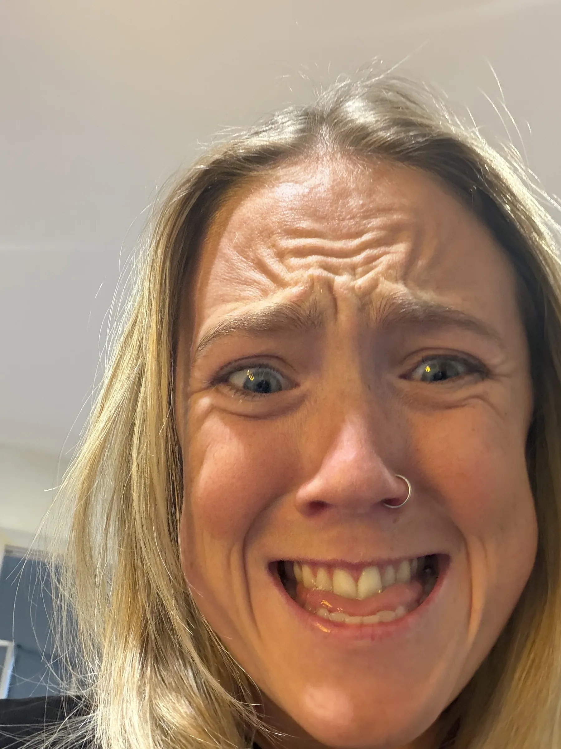 Adult female staff model raising her brows to show forehead movement during an educational assessment at Core Aesthetics