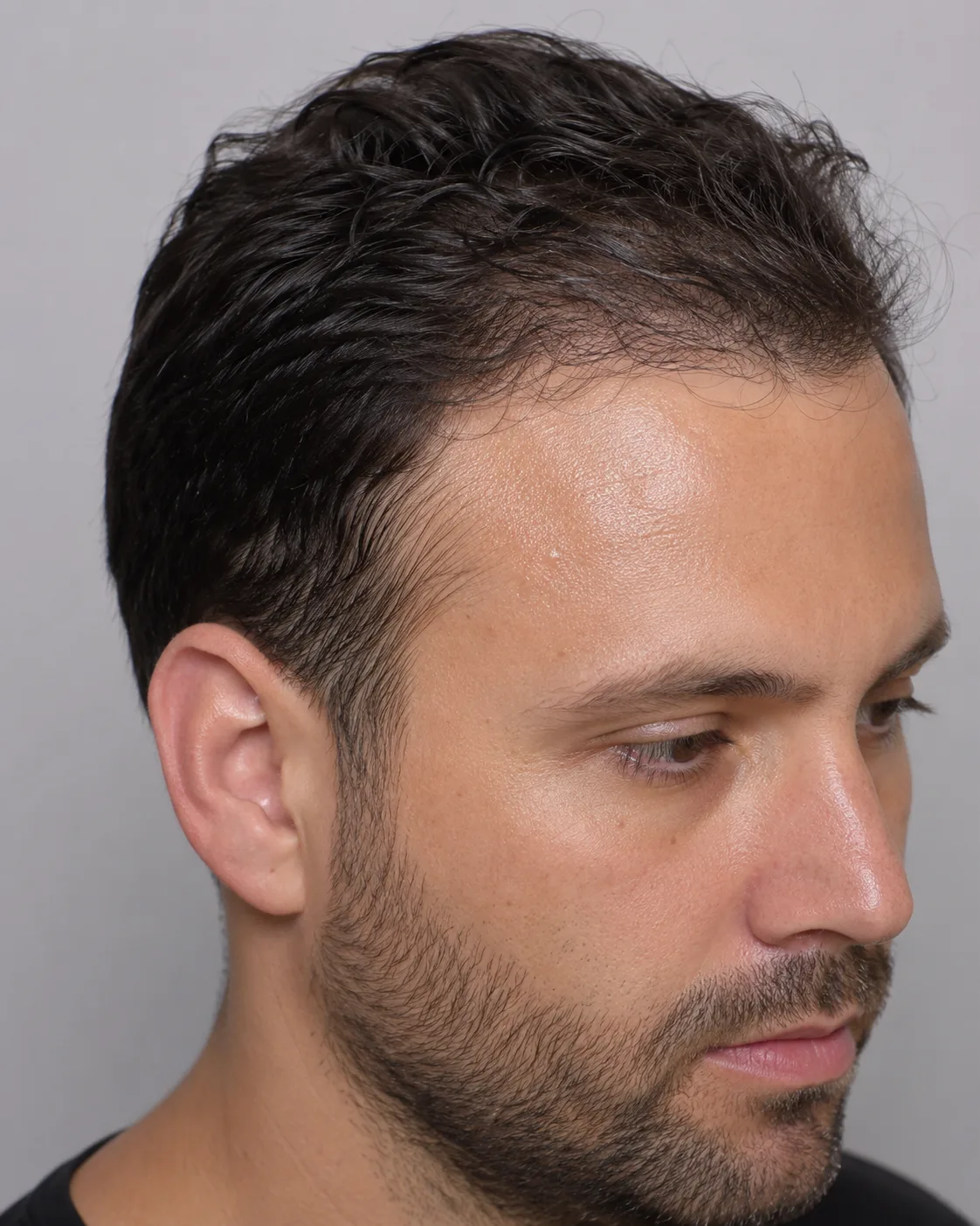 Adult skin and hairline being observed during a consultation about skin condition and cosmetic readiness