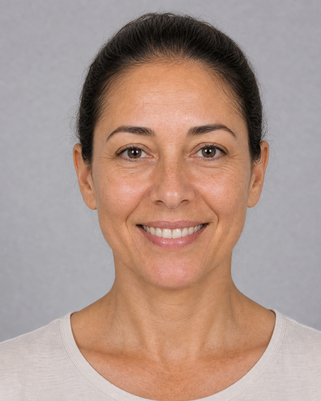 Lip and perioral consultation assessment for consultation planning at Core Aesthetics in Oakleigh
