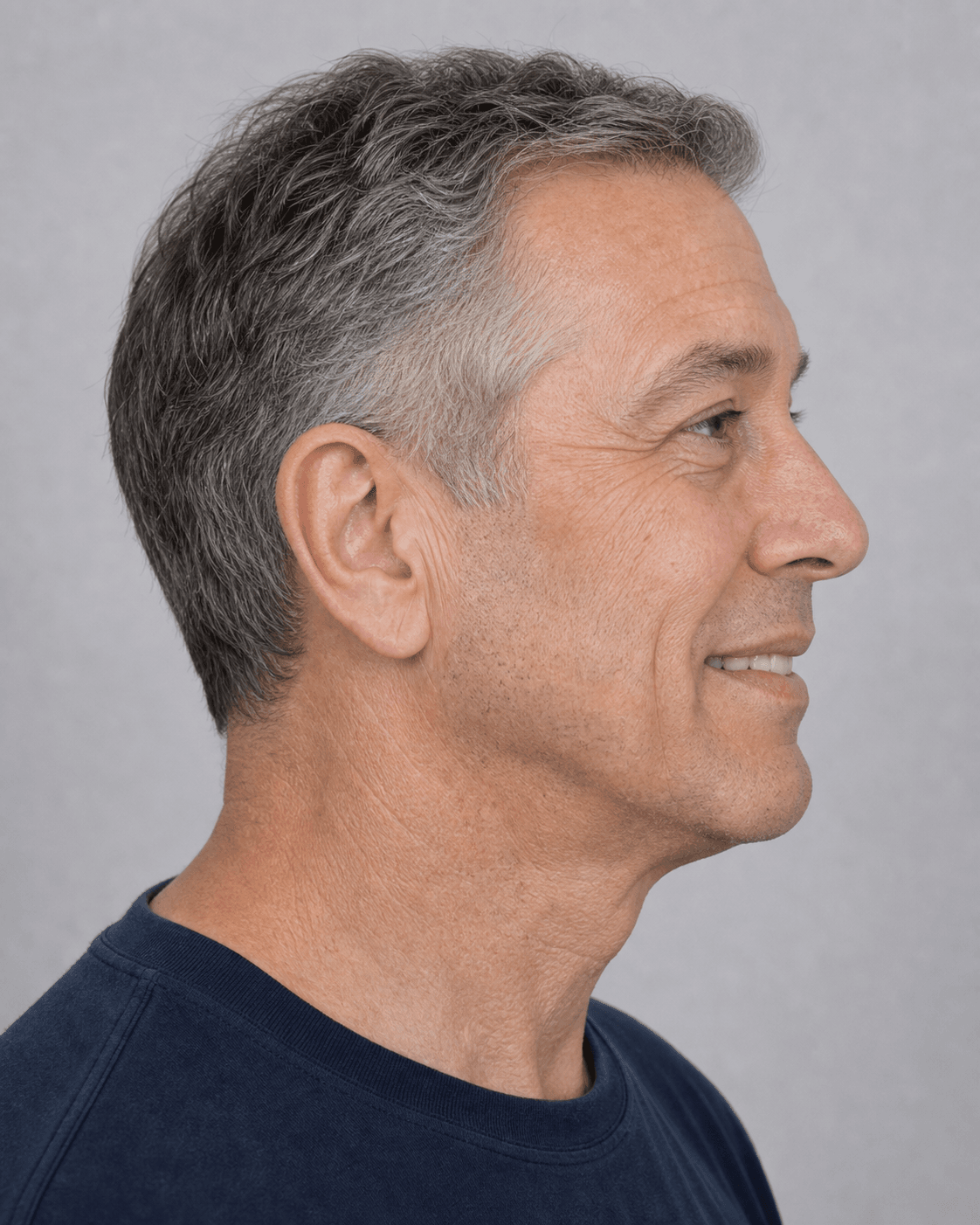 Lip and perioral consultation assessment for consultation planning at Core Aesthetics in Oakleigh