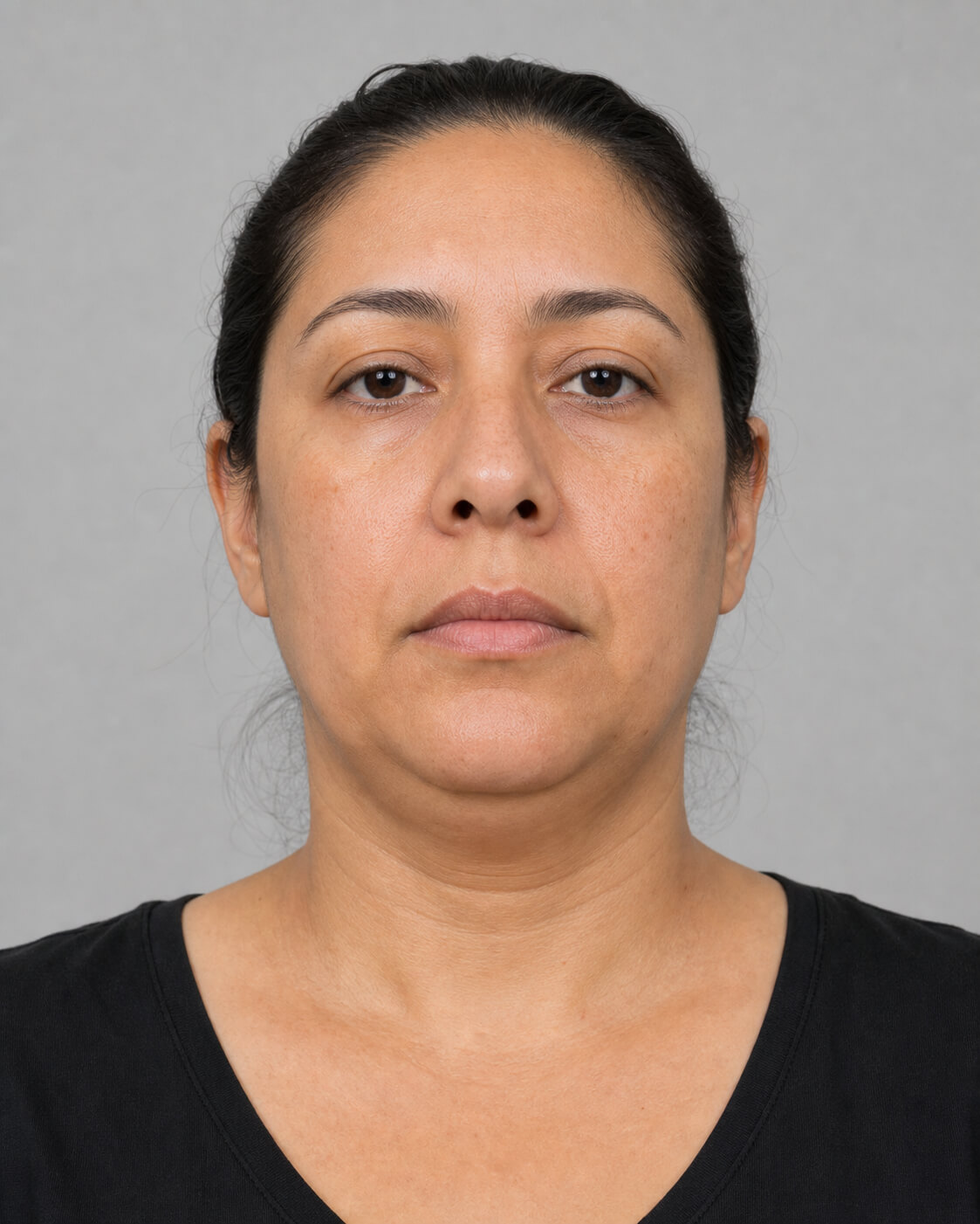 Chin and jawline consultation assessment for consultation planning at Core Aesthetics in Oakleigh