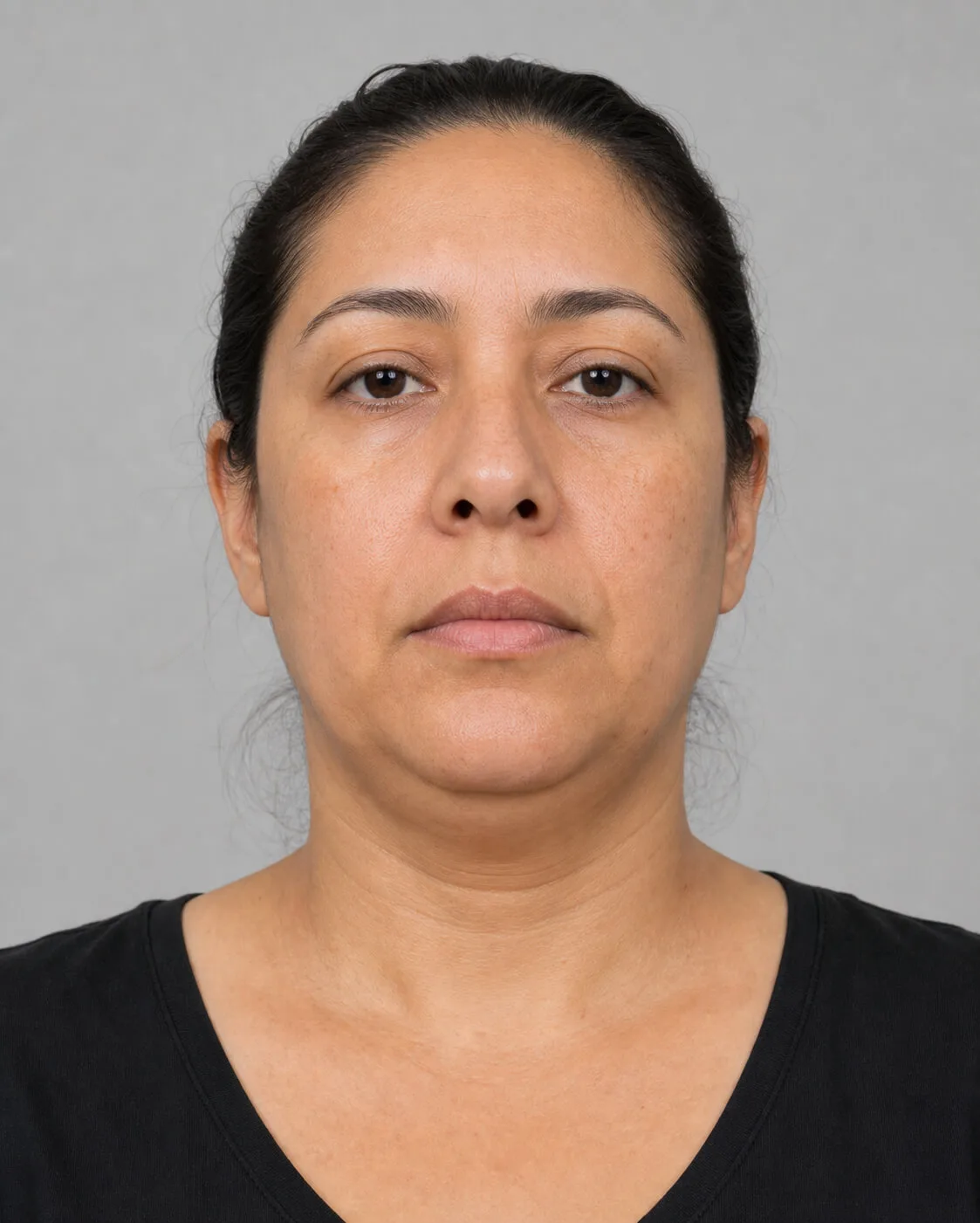 Front lower face reference used to discuss jaw muscle location and side difference near Mount Waverley