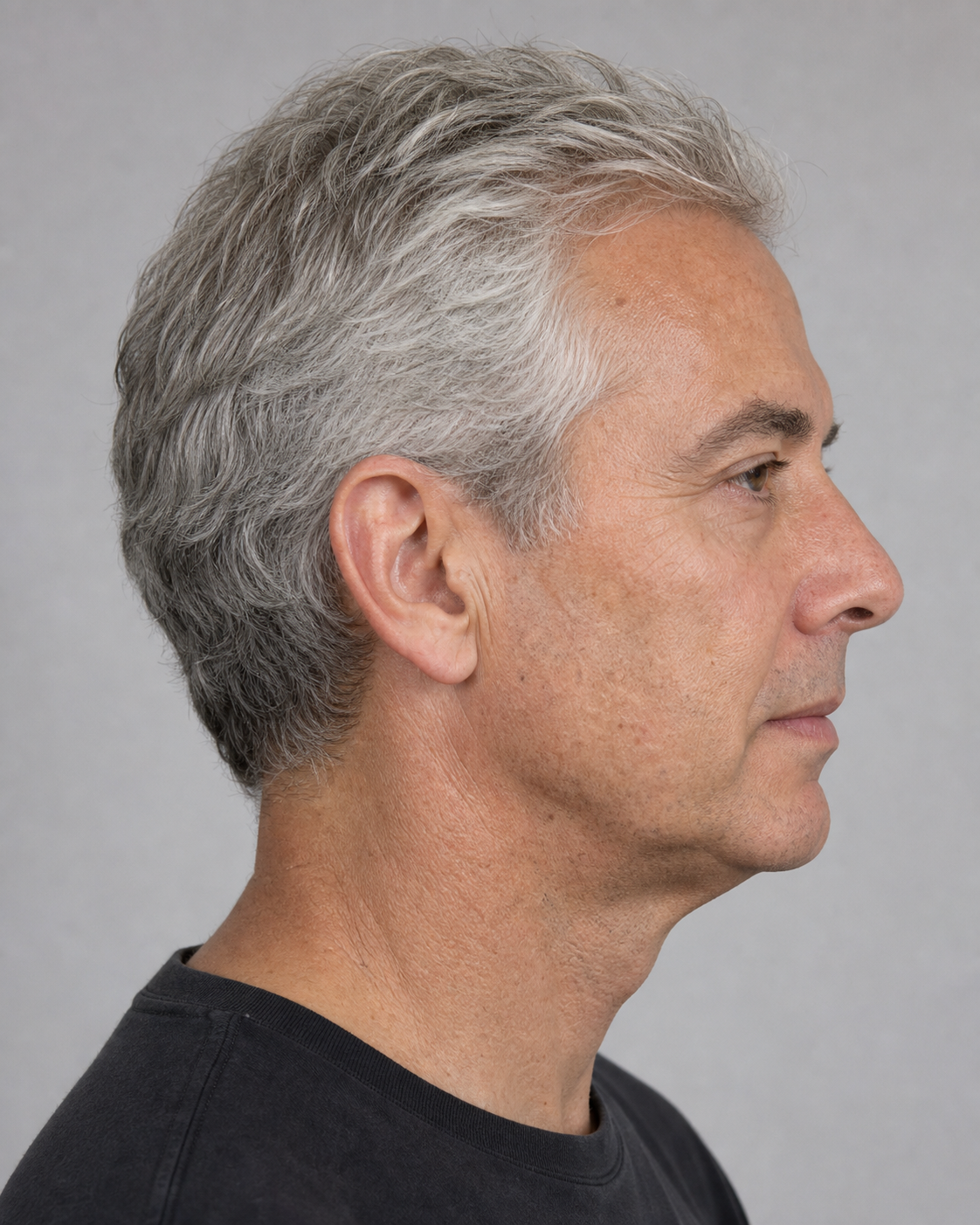 Facial structure consultation assessment for consultation planning at Core Aesthetics in Oakleigh