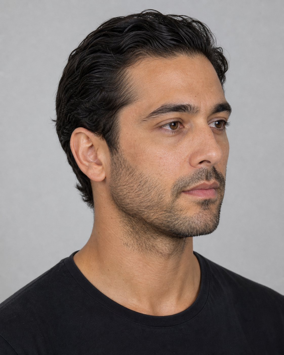 Under-eye consultation assessment for consultation planning at Core Aesthetics in Oakleigh