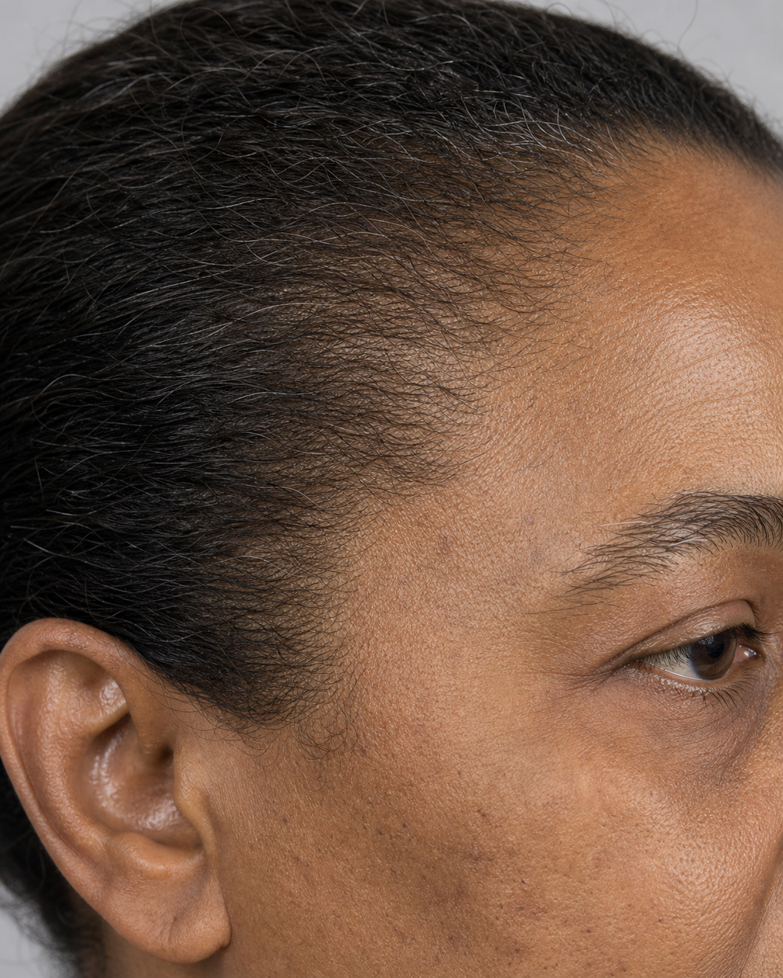 Facial ageing education and assessment context for consultation planning at Core Aesthetics in Oakleigh