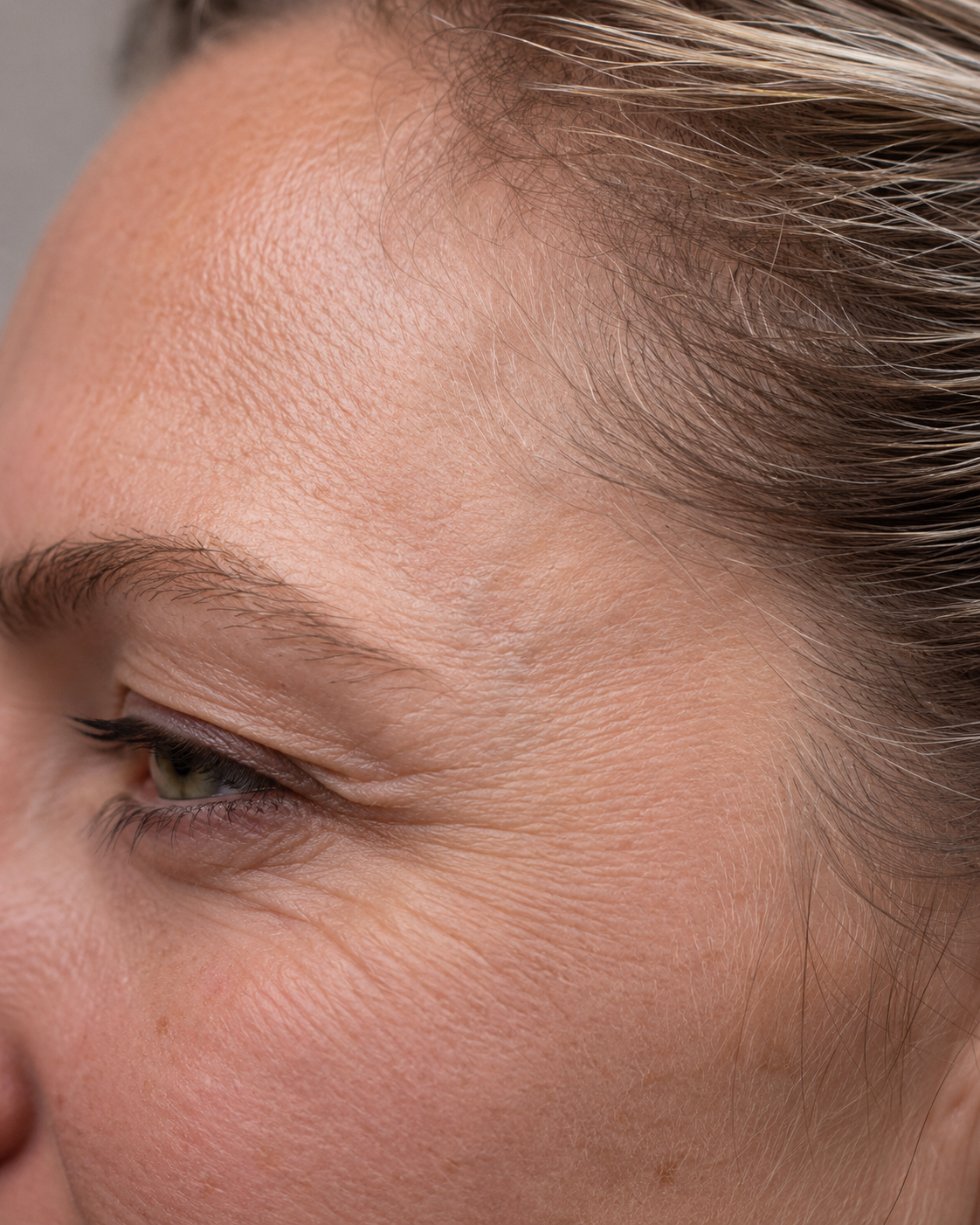 Facial ageing education and assessment context for consultation planning at Core Aesthetics in Oakleigh