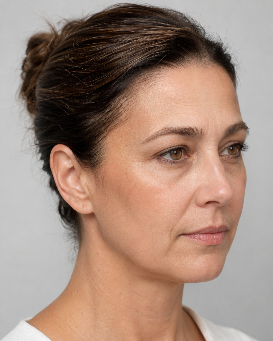 Lip and perioral consultation assessment for consultation planning at Core Aesthetics in Oakleigh