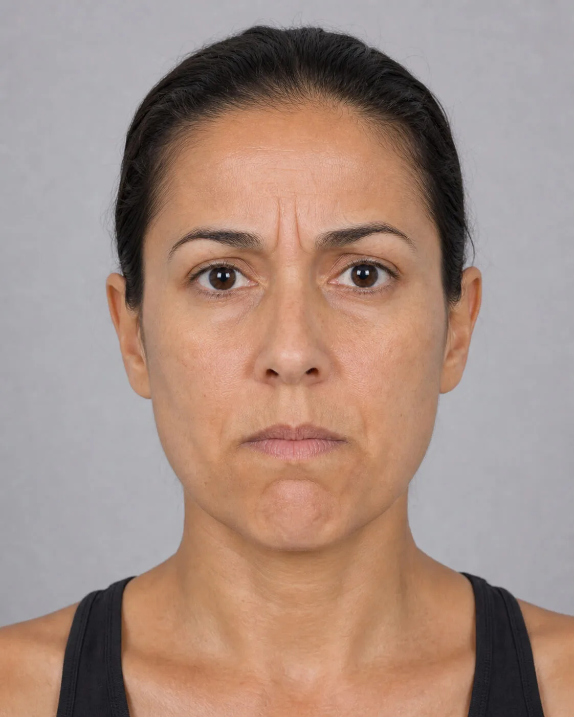 Adult woman shown from the front for a lower face consultation discussion