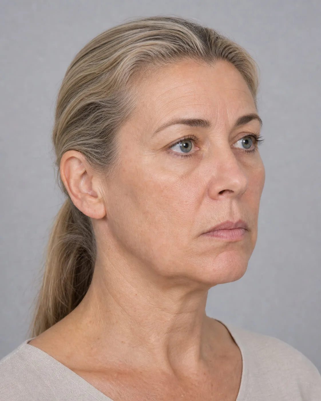 Adult patient in a three-quarter view during lower face consultation planning