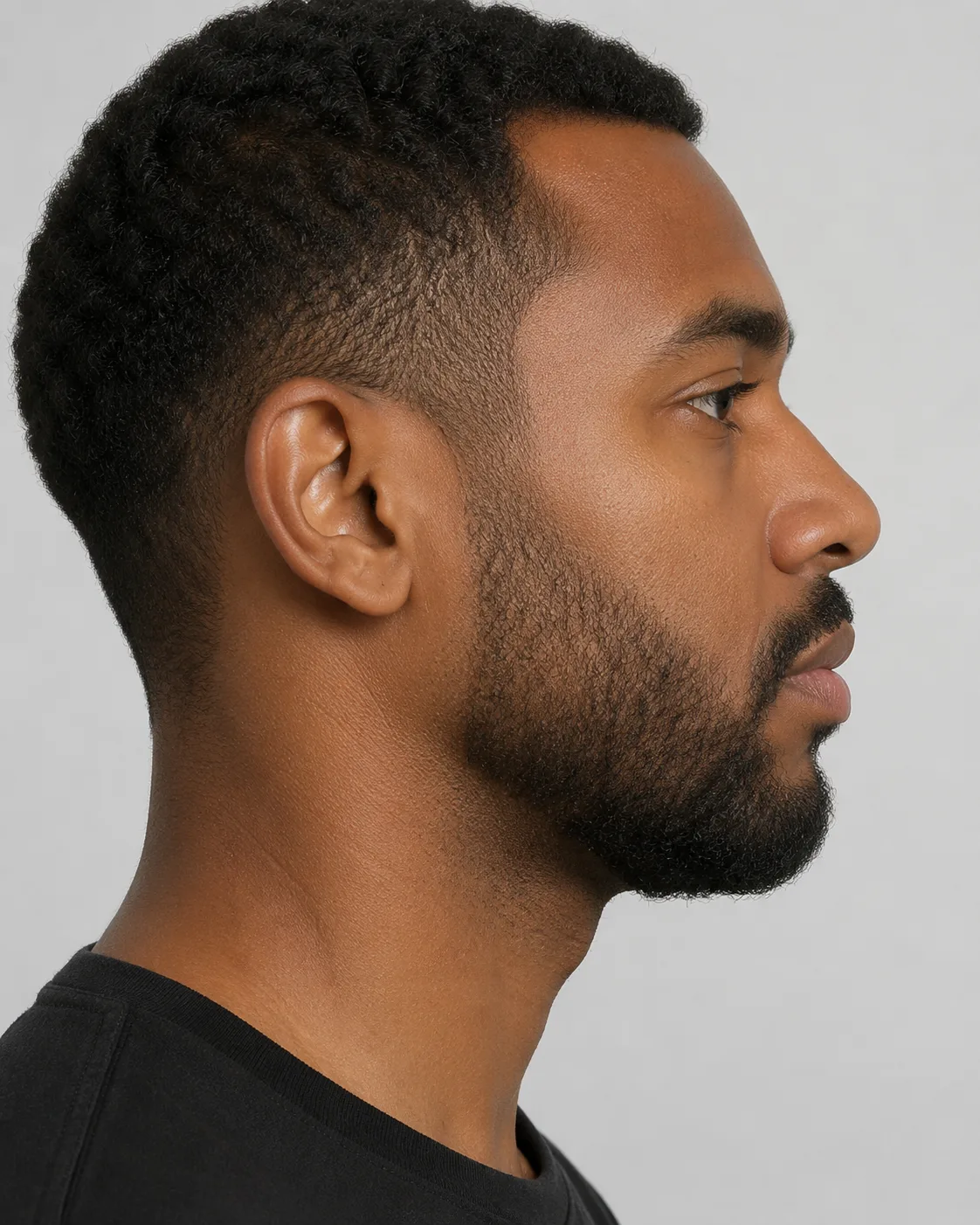 Side view used to discuss jaw muscle prominence and lower face balance during consultation planning