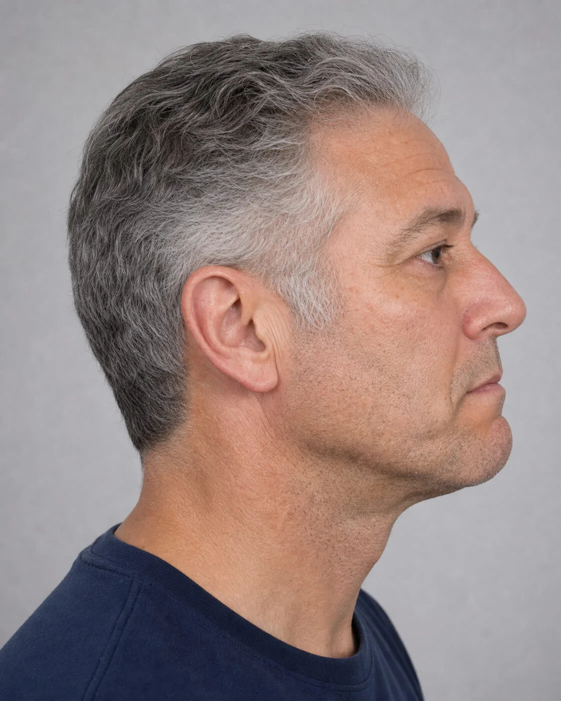 Adult man in side view during a chin profile and jawline assessment discussion