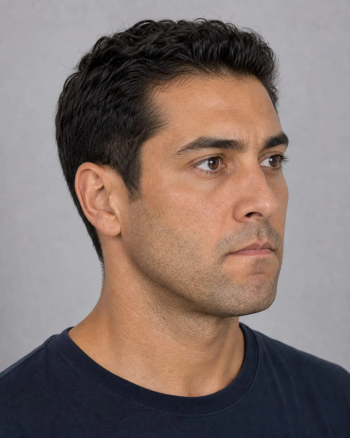 Adult patient in three-quarter view during lower face assessment planning