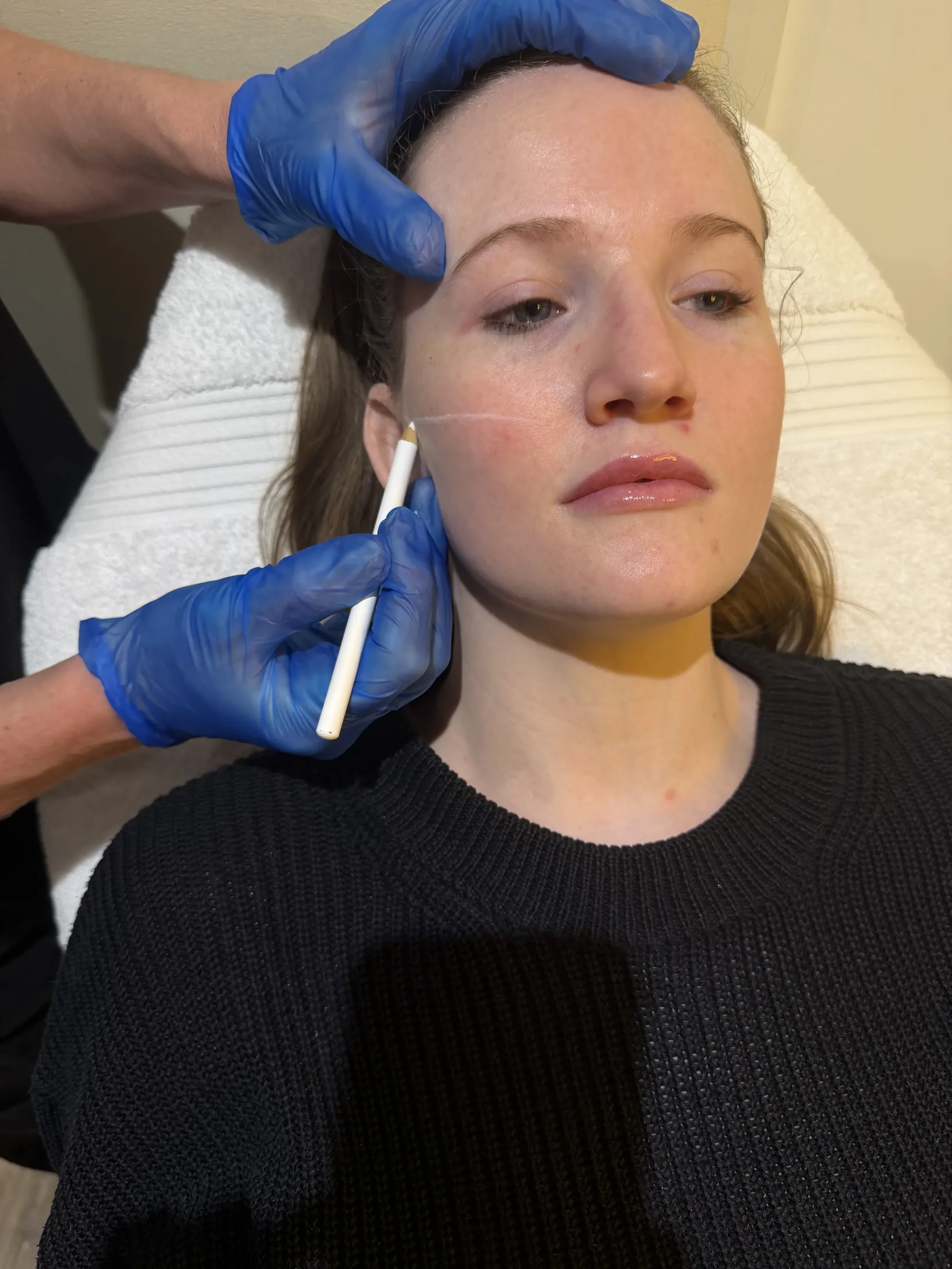 Core Aesthetics Oakleigh clinic facial volume and midface assessment consultation figure 12 supporting Questions To Bring To Your Appointment