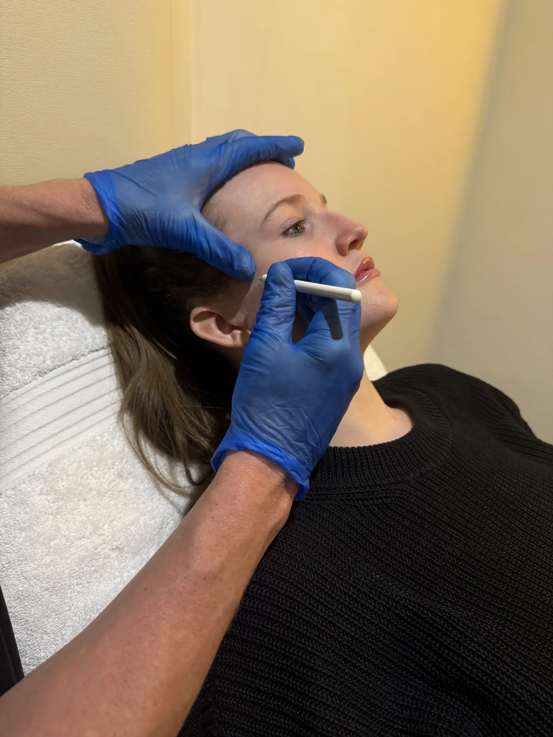 Core Aesthetics Oakleigh clinic facial volume and midface assessment consultation figure 8 supporting When Treatment May Not Be Appropriate and facial fat pads and midface support
