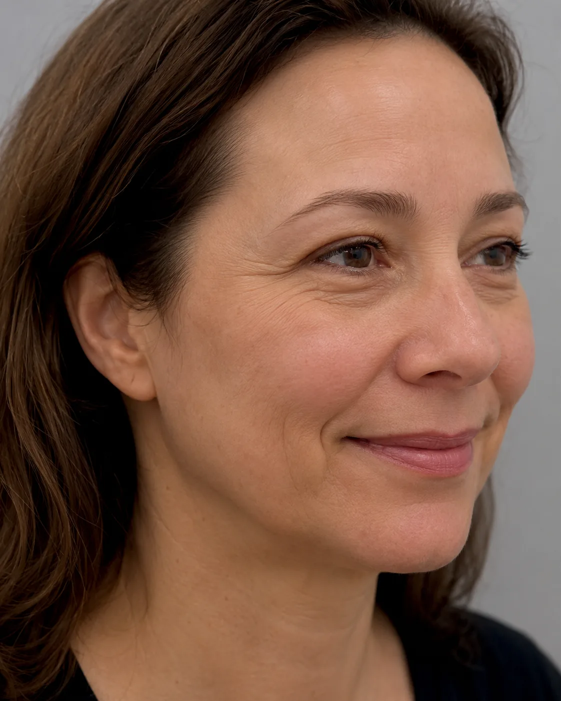 Wrinkle and upper-face consultation assessment for consultation planning at Core Aesthetics in Oakleigh