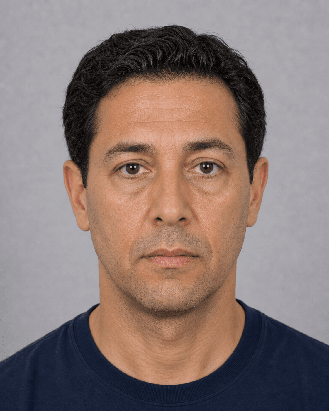 Front portrait of an adult man in even light showing natural cheek and midface anatomy