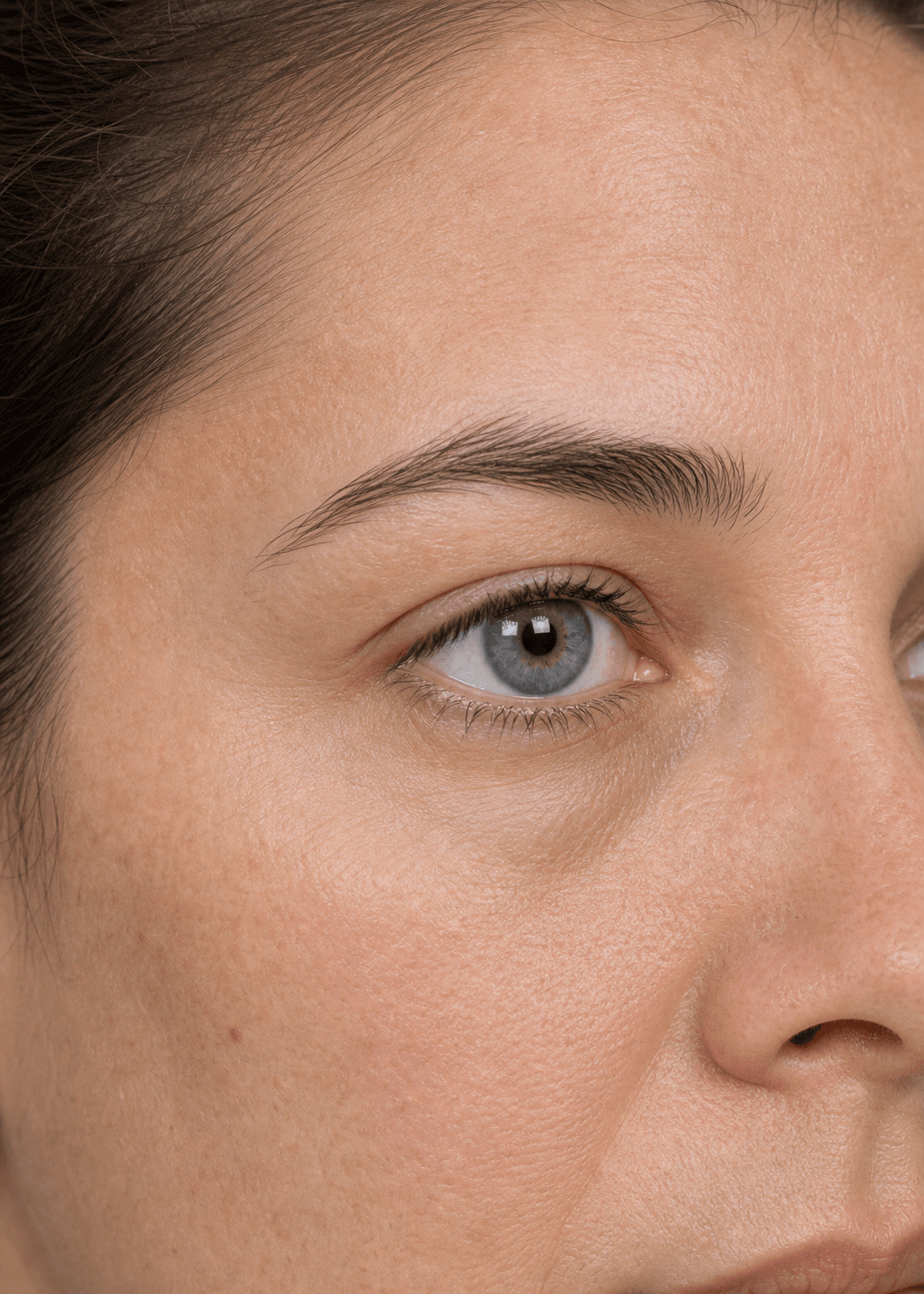 Close under eye assessment reference for tear trough consultation at Core Aesthetics Oakleigh