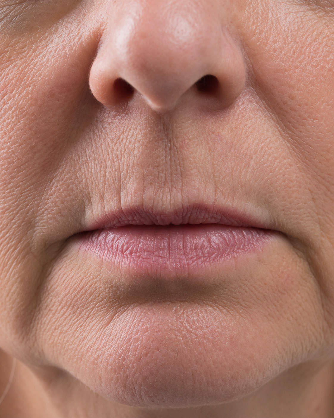 Lip and perioral consultation assessment for consultation planning at Core Aesthetics in Oakleigh