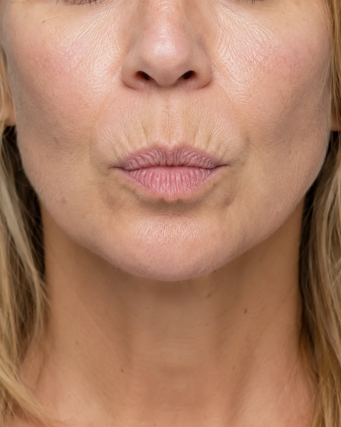 Close front view of an adult woman holding her upper lip forward