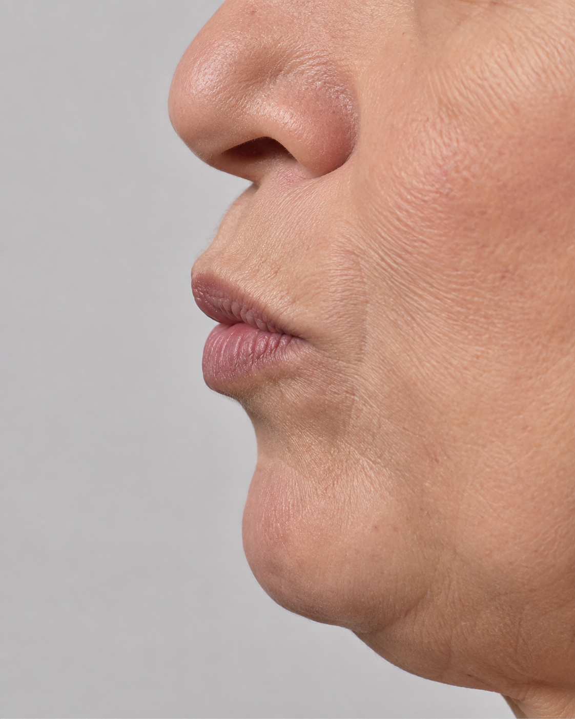 Chin and jawline consultation assessment for consultation planning at Core Aesthetics in Oakleigh