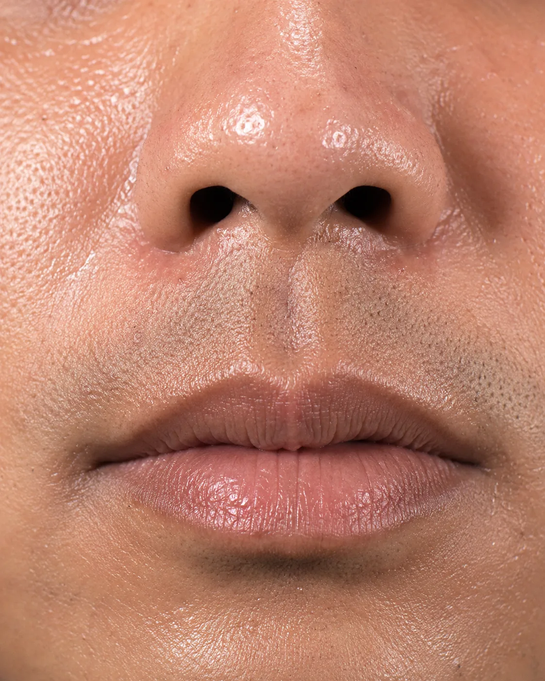 Close view used to explain that facial sweating location and frequency should be recorded separately