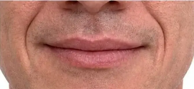 Men's aesthetic consultation context for male patient consultation context at Core Aesthetics in Oakleigh