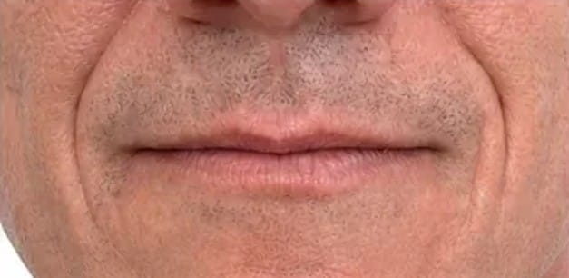 Core Aesthetics male lips natural