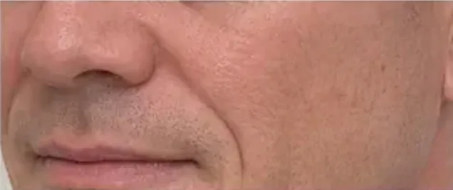 Core Aesthetics male lips side natural